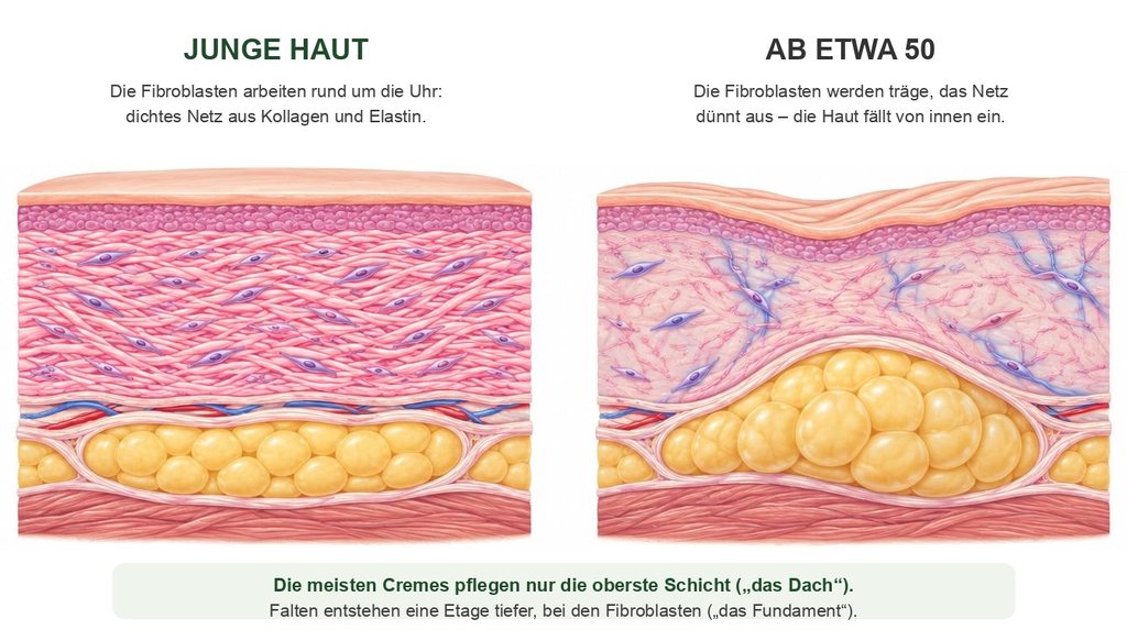 Illustration: Hautschnitt junger Haut mit aktiven Fibroblasten und Haut ab etwa 50 mit ausgedünntem Kollagennetz